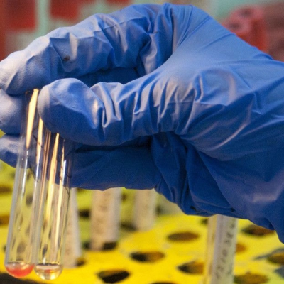 Contagios con hepatitis por transfusión de sangre: el escándalo que afectará a 400.000 personas en Reino Unido