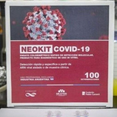 Intensifican la fabricación del test argentino para detectar el coronavirus de U$S8