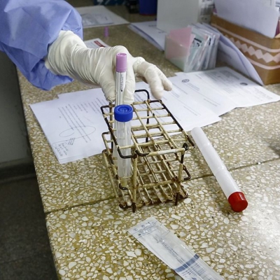 Reportan 92 nuevos casos de coronavirus en La Rioja